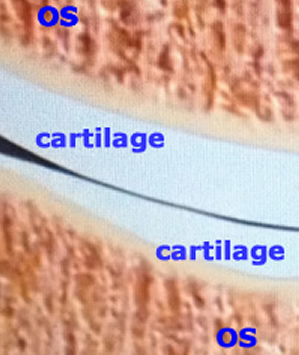coupe anatomique montrant os et cartilage 