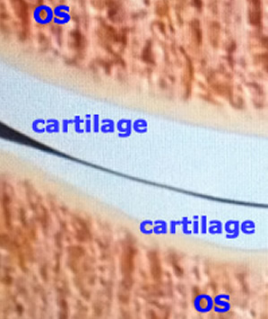 coupe d'une articulation avec l'os et le cartilage qui le recouvre