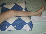 Poser le genou bloqué sur un coussin et réveiller petit à petit, le quadriceps en écrasant le coussin 