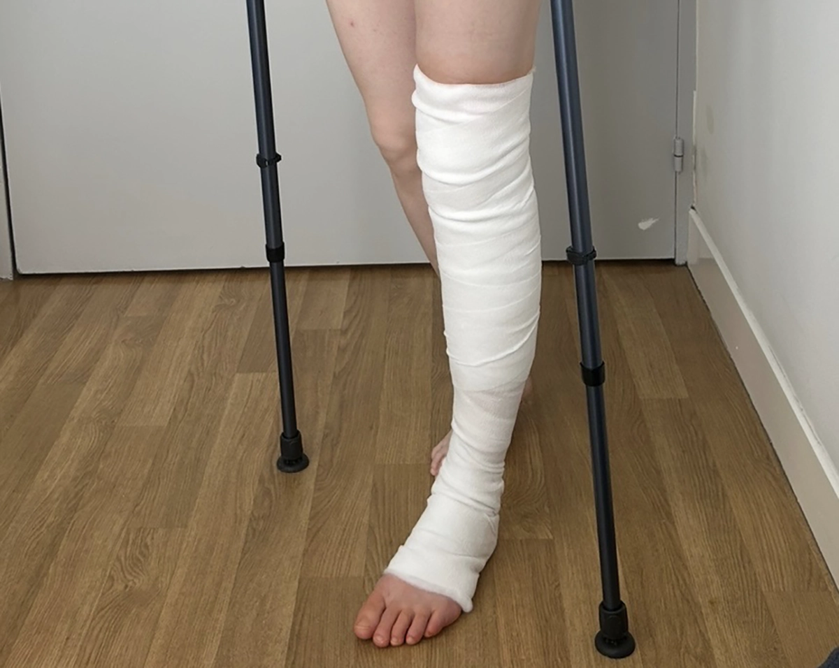 Exercices d'autorééducation et de rééducation   après prothèse du genou