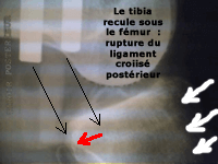 Testing radiologique : profil comparatif (1)