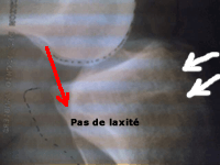 Testing radiologique : profil comparatif (2)