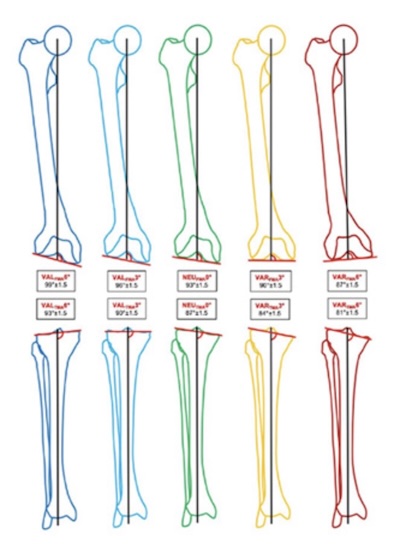 Il existe beaucoup de types différents de genoux normaux