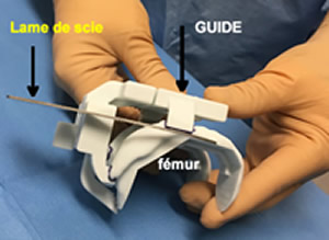 Guide de coupe sur mesure avec passage de la lame de scie
