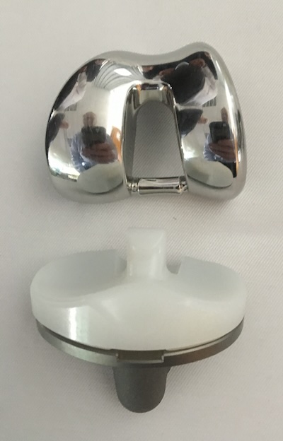 Les trois composants d'une prothèse totale de genou