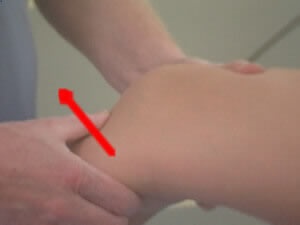 Test de Lachman pour diagnostiquer la rupture du ligament croisé antérieur