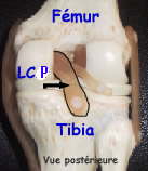 modèle du genou en plastique montrant le ligament croisé postérieur