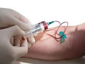 Injection du PRP dans le genou