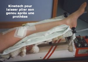 rééducation de la flexion du genou avec le kinetech